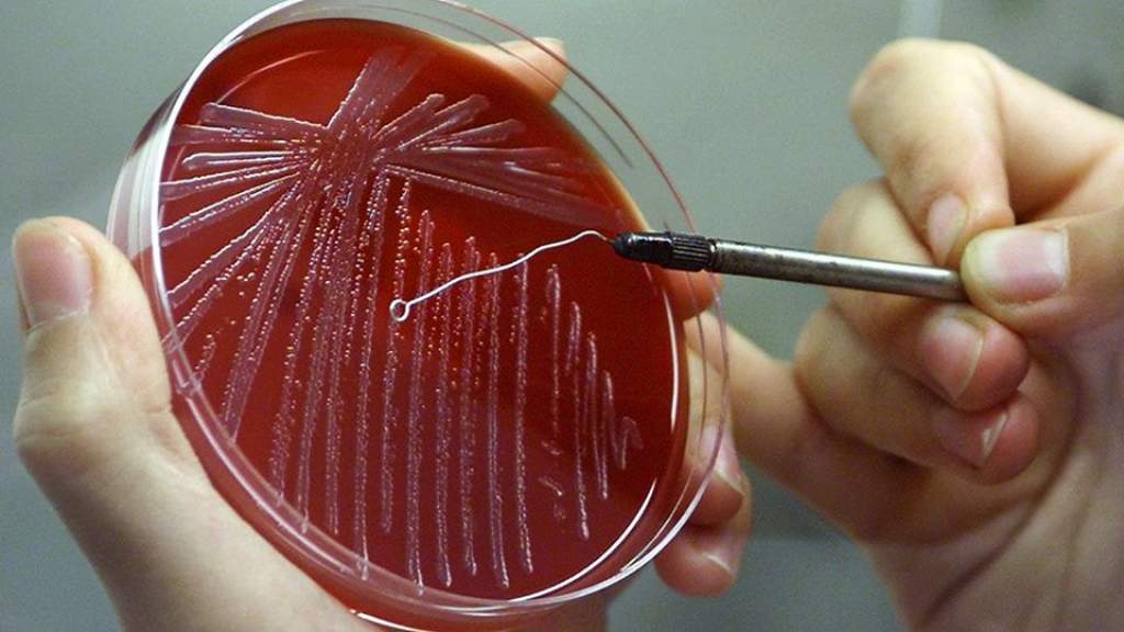 Anthrax-szal fertőzött húst találtak Kelet-Magyarországon